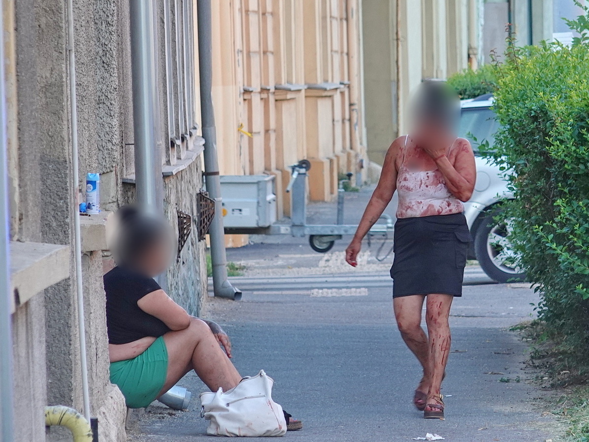 Szerelemféltés miatt fröcskölhetett a vér egy szombathelyi utcán - több embert elszállítottak a helyszínről
