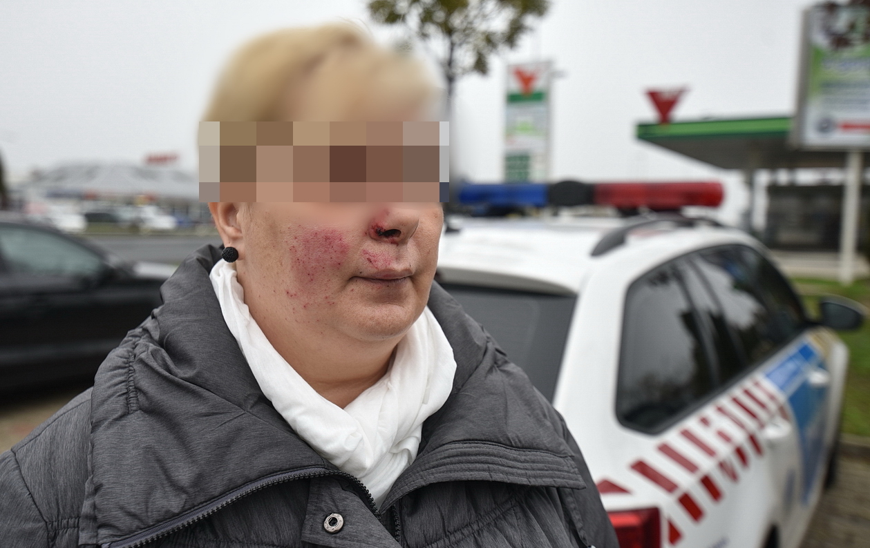 Családanyát lőtt arcon gázfegyverrel a dohánybolti rabló Szombathelyen
