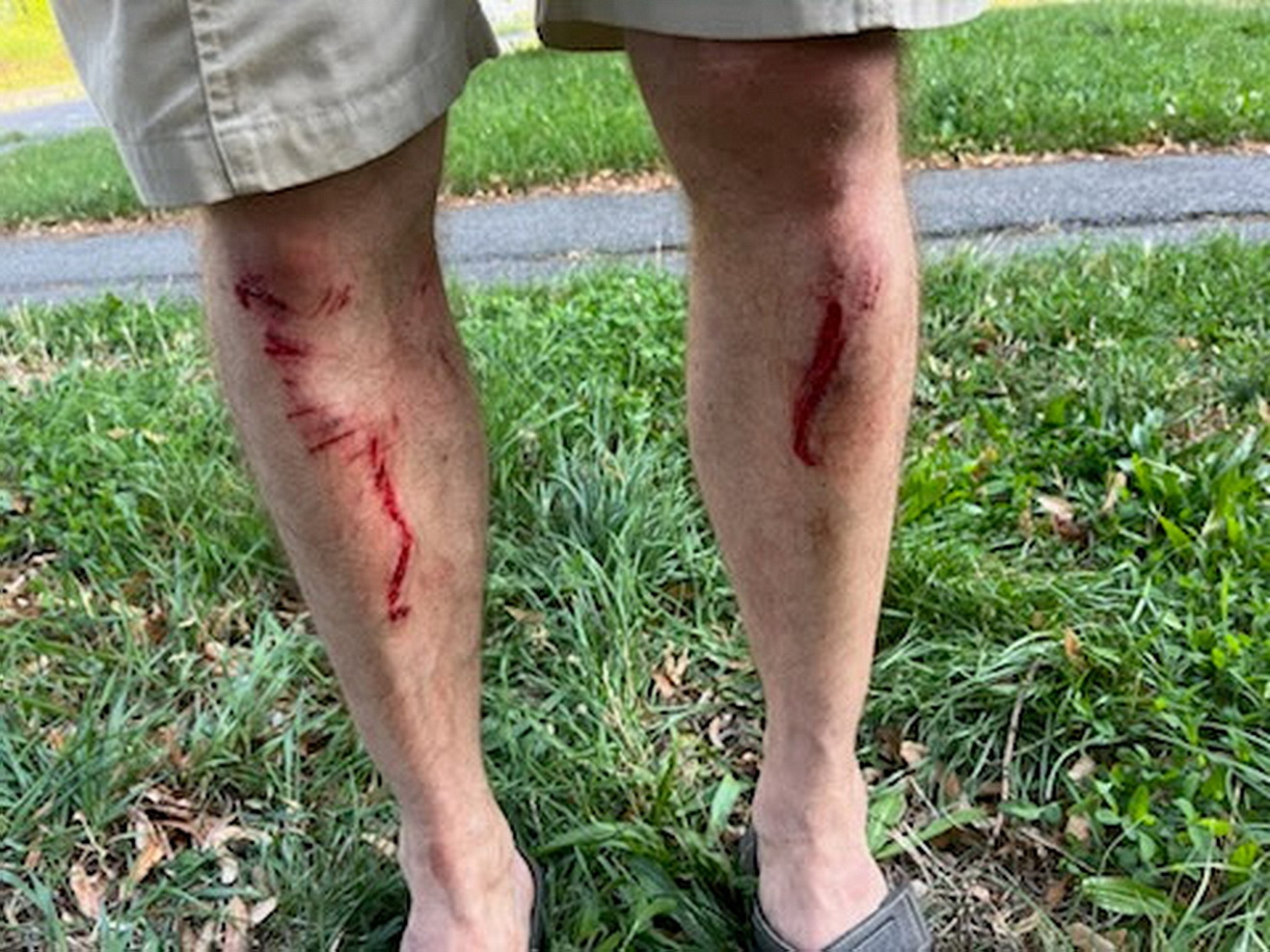 A férfi mindkét lába megsérült